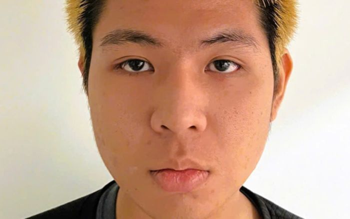 Thanh niên 18 tuổi tạt xăng đốt tình địch vì ghen tuông ở Đồng Nai