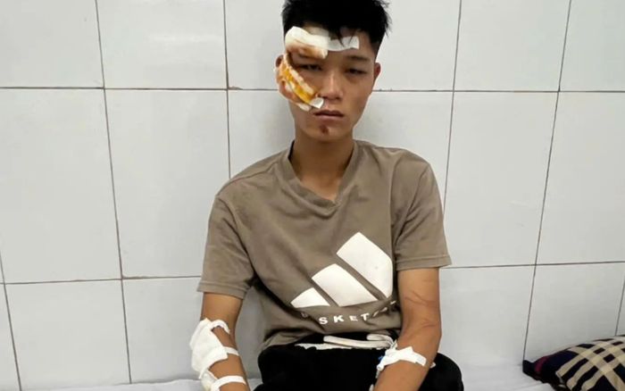 Lời khai gây phẫn nộ của quái xế thông chốt tông một Đại uý chấn thương nặng