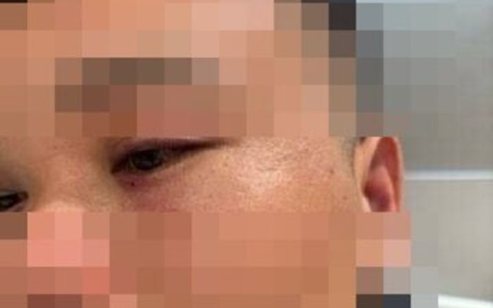 Ăn nhầm cua hấp 3 triệu đồng, người đàn ông bị hàng xóm kéo ra đường đánh hội đồng