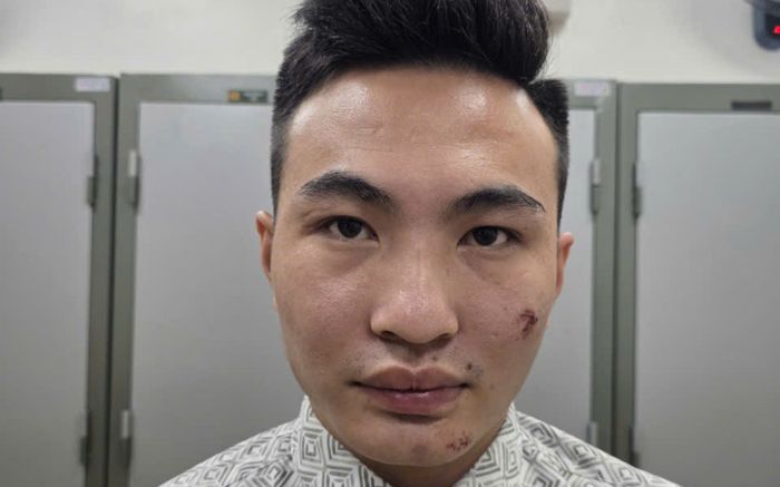 Tạm giữ hình sự Nguyễn Xuân Khải - kẻ lao xe máy vào cán bộ Công an bảo vệ A80