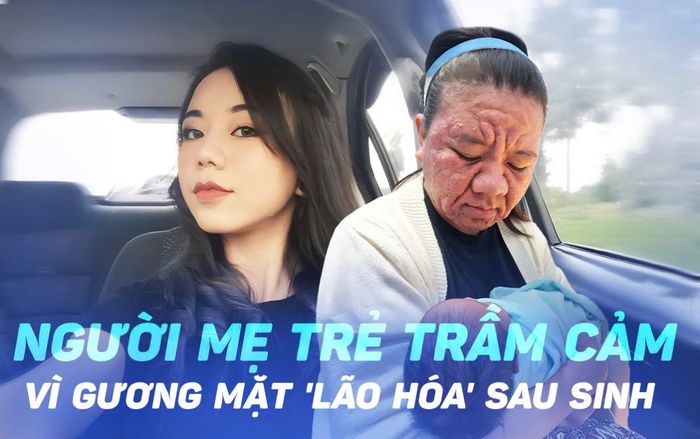 Người mẹ trẻ trầm cảm vì gương mặt 'lão hóa' sau sinh, biến đổi đến mức không nhận ra