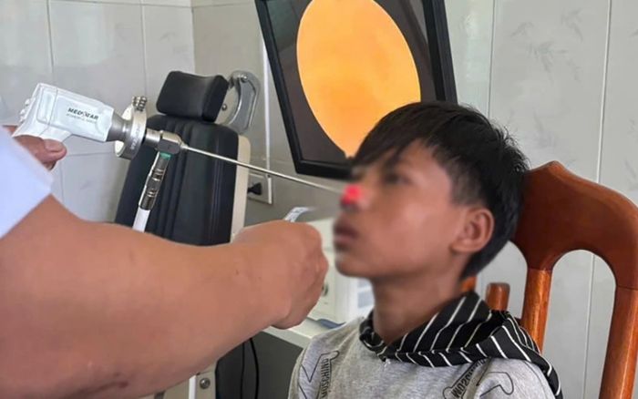 Bé trai nhập viện vì khó thở, bác sĩ tá hỏa phát hiện sinh vật 4cm ký sinh trong mũi