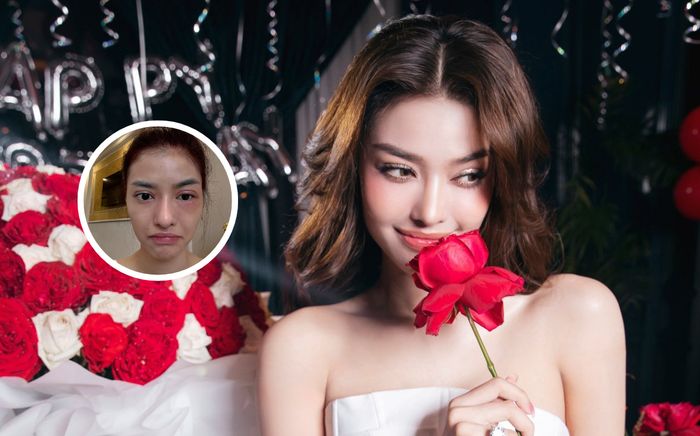 Á hậu Vbiz bị kiến ba khoang cắn, làn da sưng đỏ khiến fan lo lắng