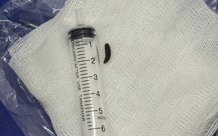 Thấy con quấy khóc, gia đình đưa đi khám phát hiện vật thể lạ trong tai