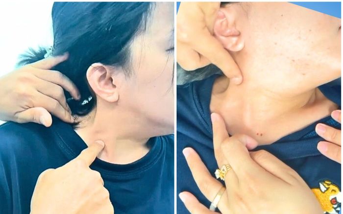 Cổ cô gái trẻ bất động vì căn bệnh hiếm gặp