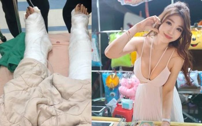 Cô gái gặp tai nạn kinh hoàng khi đi thuyền, thuyền trưởng phải bồi thường 1,8 tỷ đồng