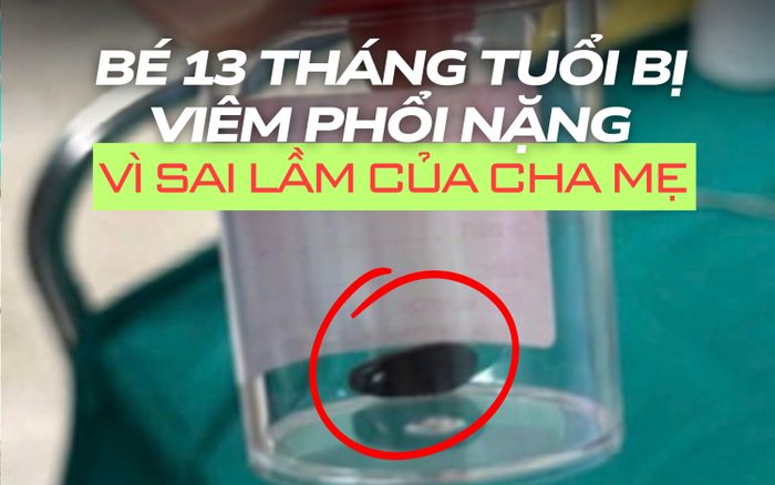 Bé 13 tháng tuổi bị viêm phổi nặng vì sai lầm phổ biến của cha mẹ