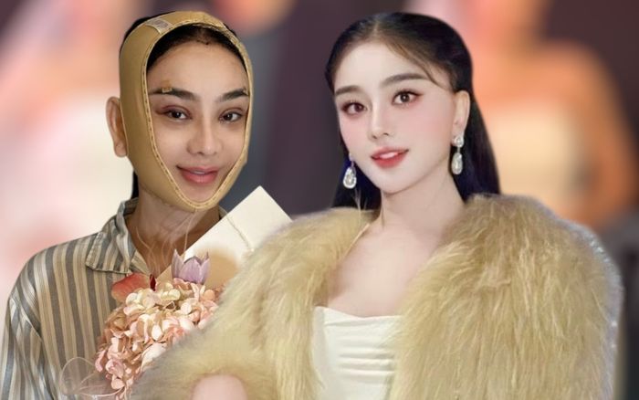 Lâm Khánh Chi tiếp tục phẫu thuật thẩm mỹ, diện mạo trên giường bệnh gây xôn xao