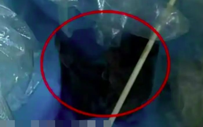 Cơ thể liên tục bốc ra mùi hôi lạ, người phụ nữ đi bệnh viện kiểm tra thì phát hiện sự việc kinh hoàng