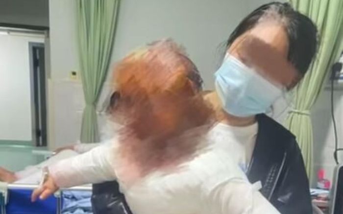 Bình đun nước sôi phát nổ trong nhà, bé trai 1 tuổi bị bỏng 40% cơ thể