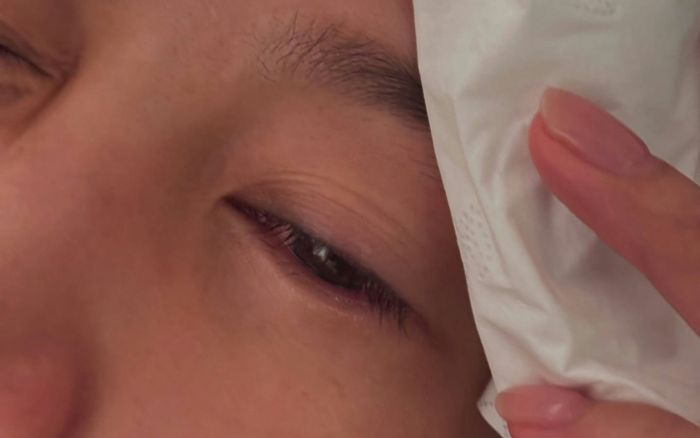 Nữ diễn viên bị rách giác mạc lúc thay quần áo, tình trạng trở nặng phải nhập viện khẩn cấp