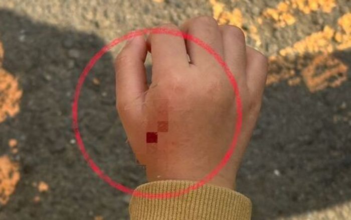 Bé gái 4 tuổi bị chó cắn, thái độ của chủ vật nuôi khiến cha mẹ quyết khởi kiện