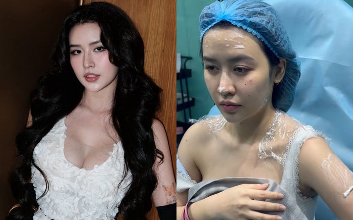 Quyên Qui 'trùng tu' nhan sắc sau khi công khai yêu bạn trai phó chủ tịch