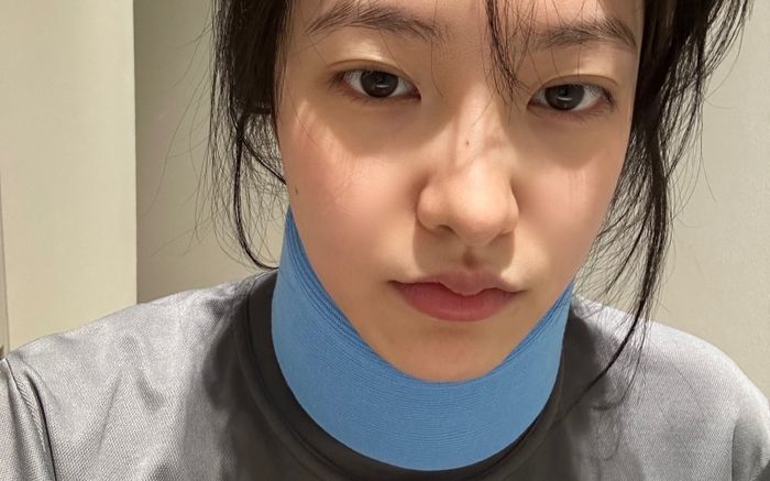 Nữ ca sĩ bị gãy cổ trong lúc tập luyện, người hâm mộ bàng hoàng