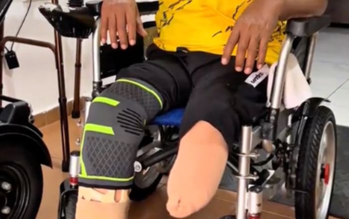 Uống nước ngọt mỗi ngày, người đàn ông phải cưa bỏ 2 chân