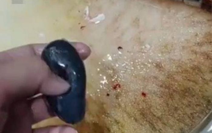 Nghe theo 'mẹo dân gian' nuốt sống mật cá để chữa đau đầu, người phụ nữ nguy kịch