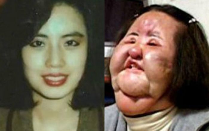 Cuộc đời bi kịch của thảm họa thẩm mỹ xứ Hàn lần đầu được phơi bày
