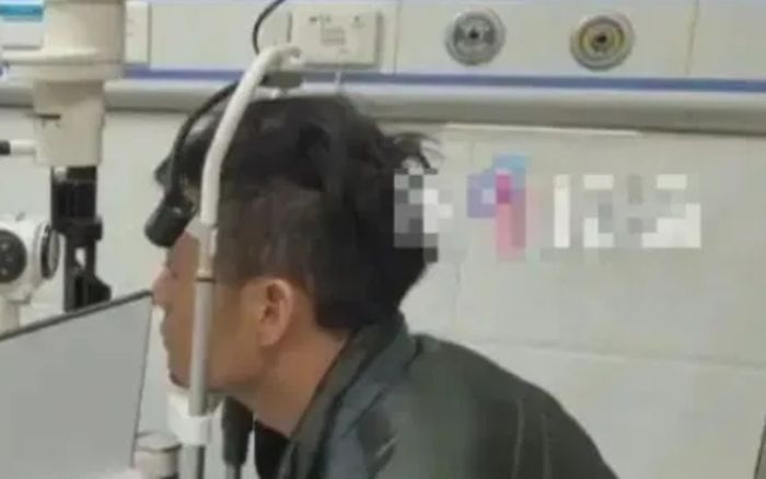 Đau mắt suốt nhiều năm, người đàn ông sốc khi bác sĩ gắp ra thứ bên trong