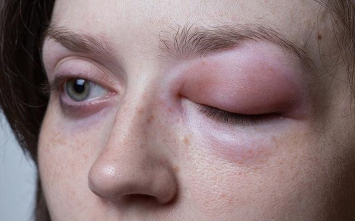 Buổi sáng xuất hiện 4 dấu hiệu này, coi chừng cơ thể đang 'kêu cứu'