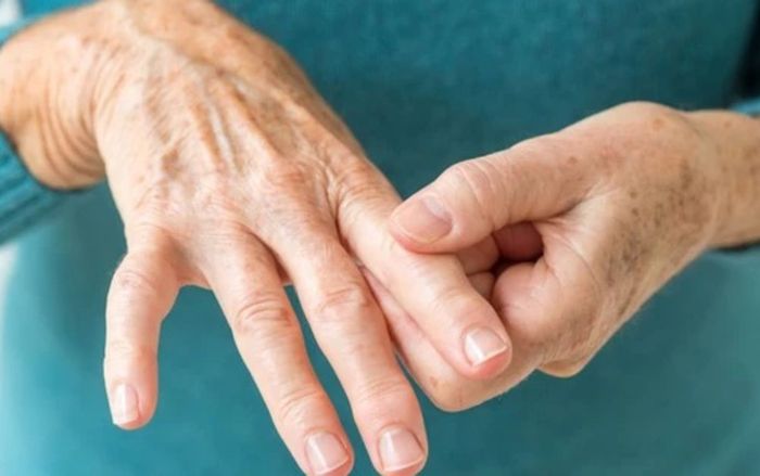 Thường xuyên tê tay vào ban đêm, coi chừng hội chứng ống cổ tay