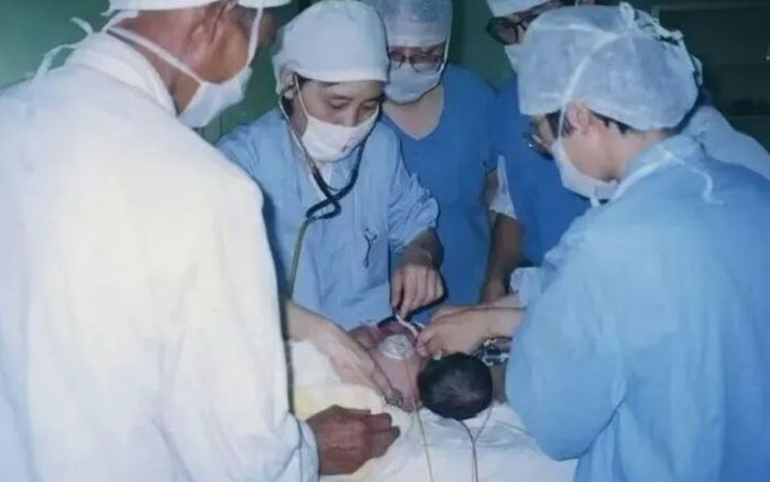 Cặp song sinh dính liền được 'tách rời', 28 năm sau phép màu xảy ra ai cũng xúc đông