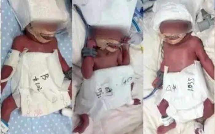 Sản phụ lên cơn đau bụng đẻ, bác sĩ kinh ngạc khi 5 đứa trẻ chào đời cùng lúc