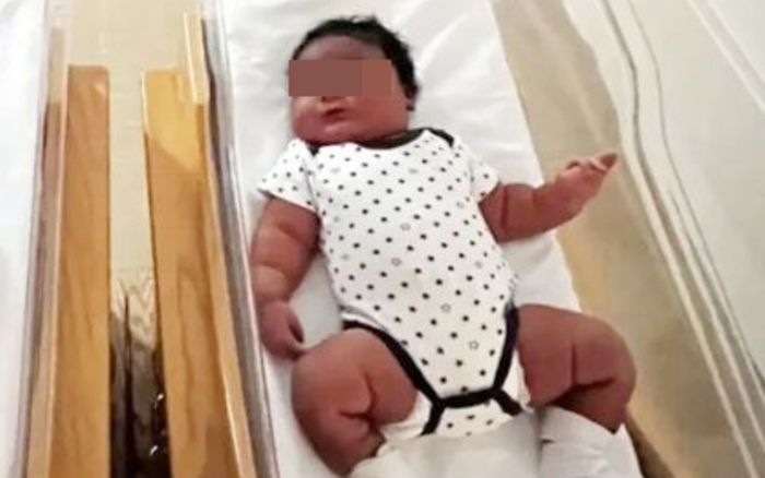 Người mẹ sinh ra đứa trẻ sơ sinh 'khổng lồ', cả bệnh viện xôn xao