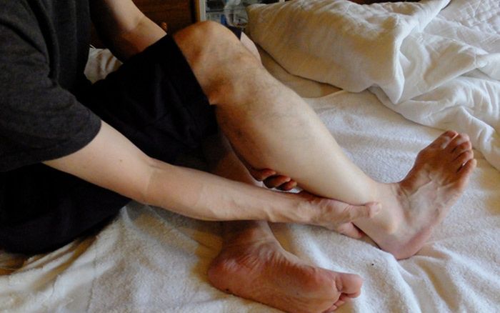 Tại sao nhiều người hay bị chuột rút ban đêm, nguyên nhân có thể đến từ thói quen hằng ngày