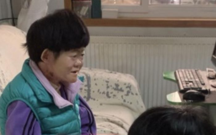 Cô gái có làn da 'mong manh như cánh bướm' từng bị bác sĩ nói sống không quá 2 tuổi, cuộc sống hiện tại khiến ai cũng xúc động