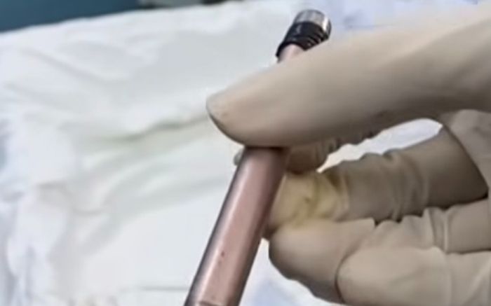 Thiếu nữ 16 tuổi phải nhập viện trong đêm bởi hành động khó nói, bác sĩ lập tức khuyến cáo đến phụ huynh