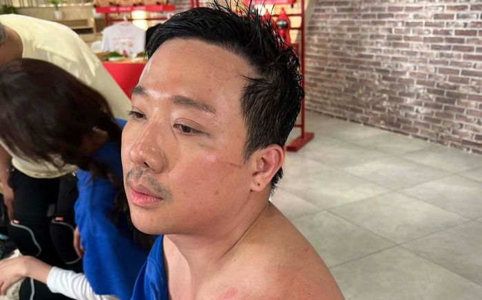 Trấn Thành sa sút