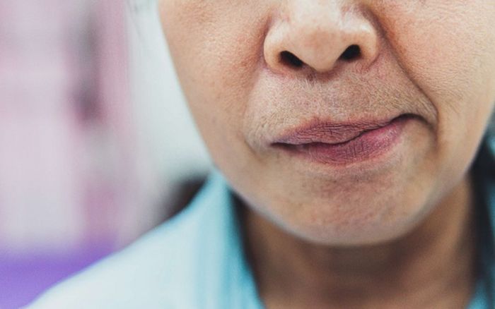 3 biểu hiện cảnh báo đột quỵ có thể xuất hiện trước vài ngày, đáng nói nhiều người lại chủ quan