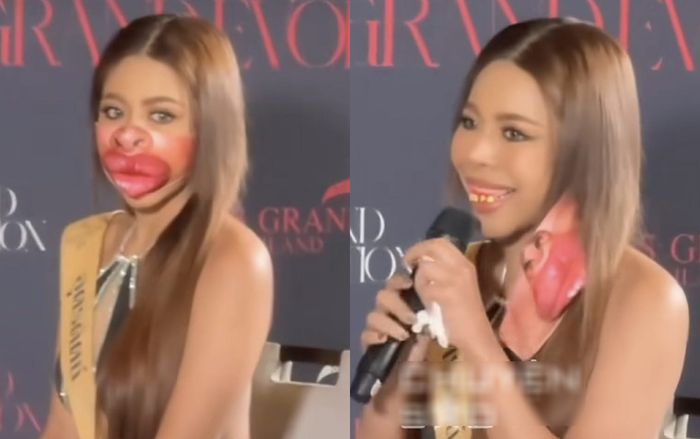 Thí sinh Hoa hậu Hòa bình Thái Lan đeo răng giả đi thi