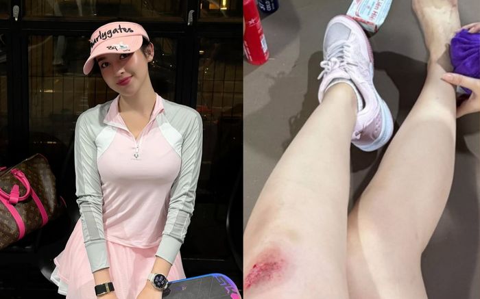 Gặp tai nạn khi chơi pickleball, Á hậu Huyền My khiến fan lo lắng