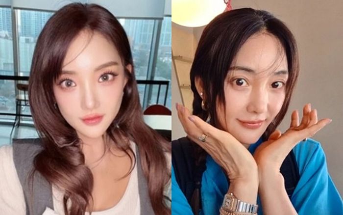 Nữ ca sĩ Bada (S.E.S) lên tiếng trước nghi vấn phẫu thuật thẩm mỹ