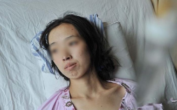 Người phụ nữ ăn một loại rau củ suốt thời gian dài, lúc đi khám bàng hoàng phát hiện ung thư