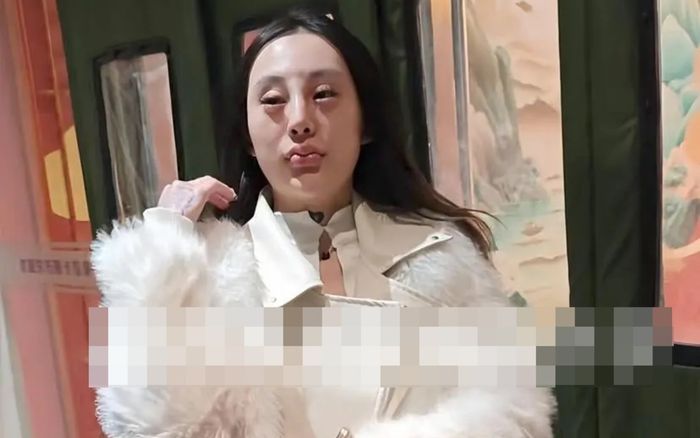 Cô gái 'dao kéo' xong bị bạn trai chia tay, phản ứng bạn thân khi gặp lại gây sốc