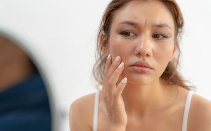 Những dấu hiệu nhỏ trên da nhưng cảnh báo vấn đề nghiêm trọng bên trong cơ thể