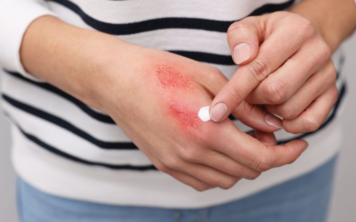 5 dấu hiệu cơ thể tưởng bình thường nhưng có thể liên quan đến ung thư