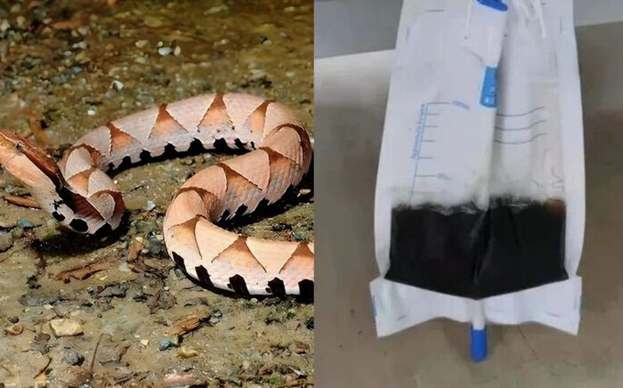Người đàn ông bị rắn cực độc cắn khi quét sân, nước tiểu chuyển sang màu đen