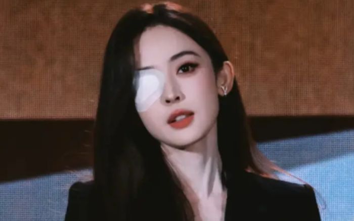 Cổ Lực Na Trát khiến fan lo lắng vì băng kín một bên mắt tại sự kiện