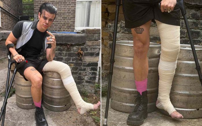 Yungblud gãy chân trong tai nạn xe máy, tuyên bố vẫn biểu diễn