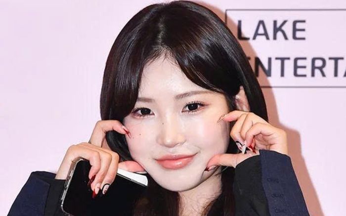 Choi Joon Hee gây chú ý với diện mạo hiện tại