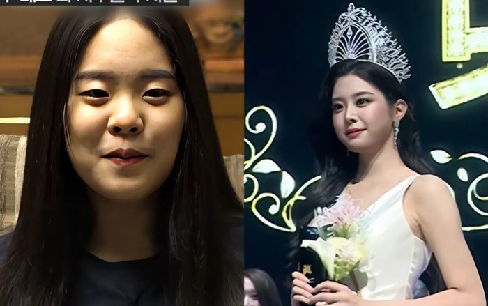 Tân Hoa hậu Hàn Quốc vướng nghi vấn phẫu thuật thẩm mỹ