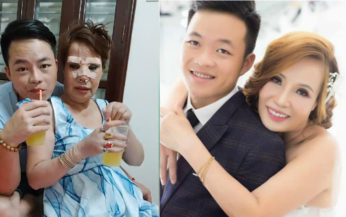 Nhan sắc gây chú ý của 'cô dâu 62 tuổi' ở Cao Bằng sau một tháng phẫu thuật thẩm mỹ