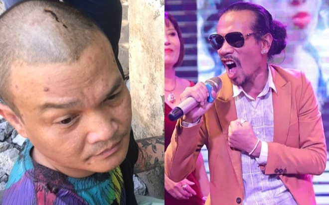 Bắt đối tượng cầm súng bắn trọng thương ca sĩ Hồ Phàm trong đêm