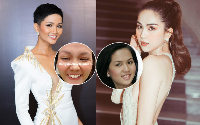 Không cần dao kéo đau đớn, H'Hen Niê, Ngọc Trinh lột xác hoàn toàn nhờ cách làm đẹp này