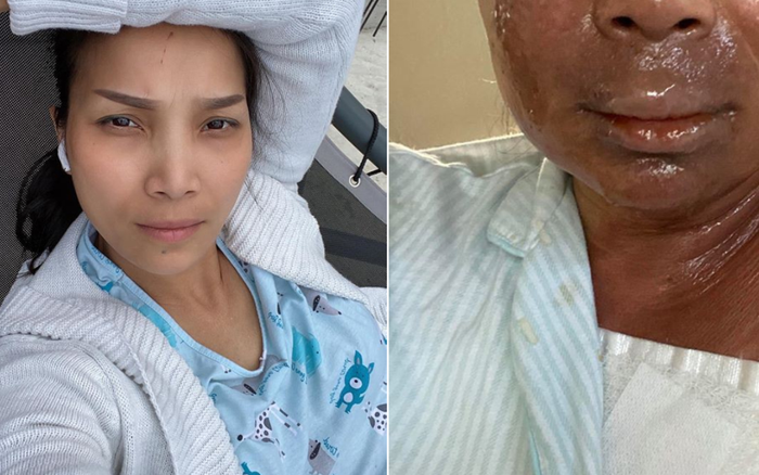 Bất ngờ gương mặt hiện tại của Hồng Ngọc sau sự cố nổ nồi hơi tại Mỹ