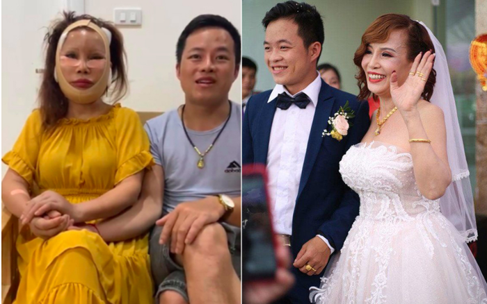 'Cô dâu 62 tuổi' tiếp tục phẫu thuật thẩm mỹ làm căng da mặt, thành quả sau khi 'dao kéo' khiến dân tình không khỏi 'rùng mình'