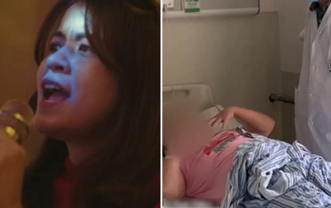 Vỡ mạch máu não khi hát karaoke nốt cao